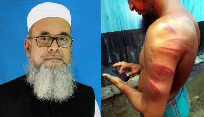 সকালে গ্রেফতার, বিকেলে জামিন শিক্ষক পেটানো চেয়ারম্যানের