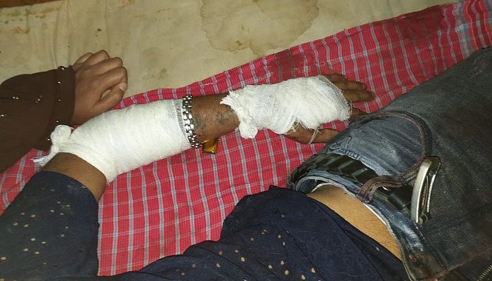 খুলনায় ২ যুবককে কুপিয়ে জখম 