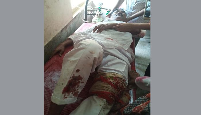 পাবনায় সন্ত্রাসীদের হামলায় গুরুতর আহত ইউপি চেয়ারম্যান 