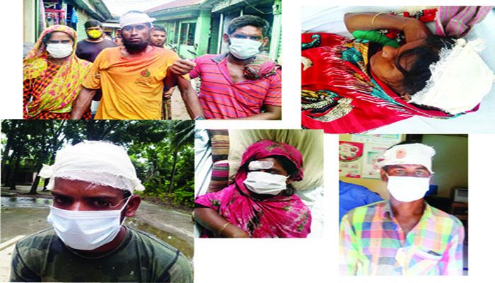 পাবনায় দুপক্ষের রক্তক্ষয়ী সংঘর্ষে আহত ৭ 
