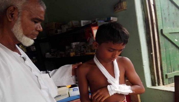 বাগেরহাটে ইউপি সদস্যের বিরুদ্ধে শিশুকে নির্যাতনের অভিযোগ