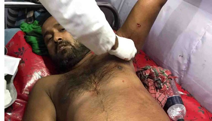 বঙ্গবন্ধু সাফারি পার্কে বাঘের থাবায় কর্মচারী আহত