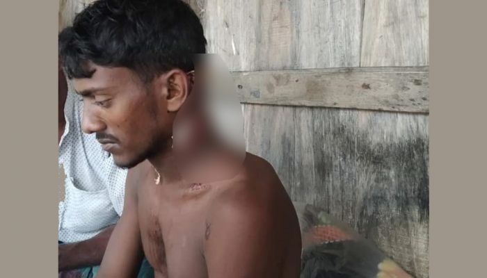 সাতক্ষীরায় বাঘের আক্রমণে মৌয়াল আহত