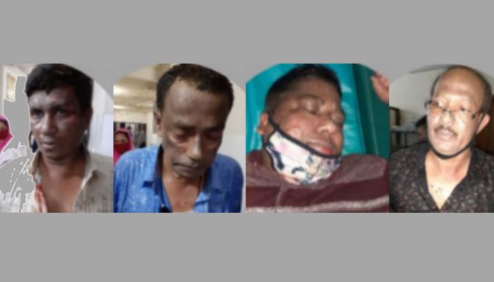 তাস খেলার সময় গ্যাস লাইট বিস্ফোরণে দগ্ধ ৫