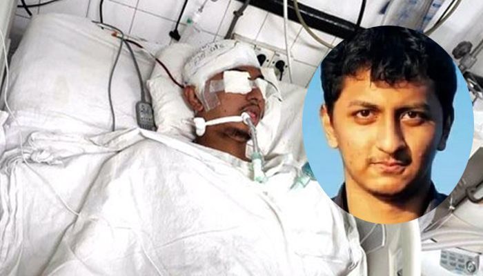 মাথার হাড় পেটে নিয়ে বাড়ি ফিরলেন সেই আকিব