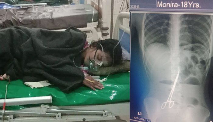 তরুণীর পেটে কাঁচি রেখে সেলাই: কাউকে দায়ী করছে না তদন্ত কমিটি