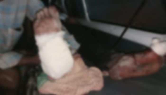 গুপ্তধন ভেবে কেটে ফেললেন মর্টার শেল, অতঃপর