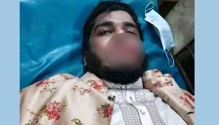 ইসলামী বক্তার জিহ্বা কেটে দিয়েছে দুর্বৃত্তরা