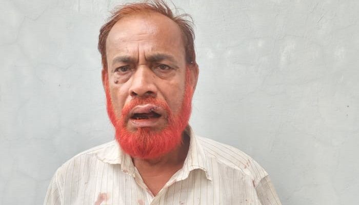কোম্পানীগঞ্জে আ.লীগ নেতাকে পিটিয়ে আহত