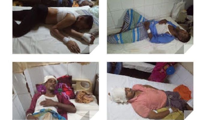 নোয়াখালীতে নির্বাচনী সহিংসতায় গুলিবিদ্ধ ৫