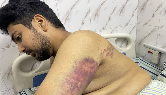 ‘জ্ঞান ফিরলে দেখি বড় রাস্তার পাশে পড়ে আছি’