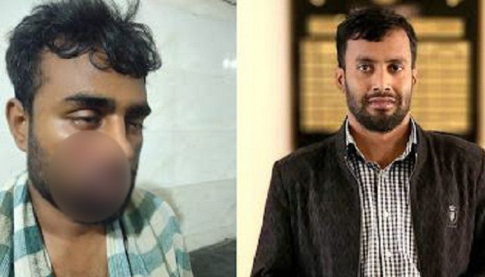পাবিপ্রবির হলে এক শিক্ষার্থীকে পিটিয়েছে ছাত্রলীগ নেতা