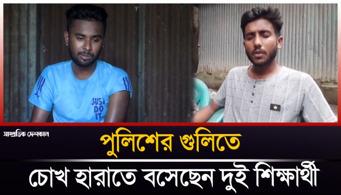 সিরাজগঞ্জে ছাত্র আন্দোলনে পুলিশের গুলিতে চোখ হারাতে বসেছে দুই শিক্ষার্থী