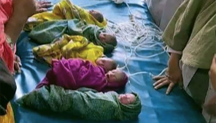রামেক হাসপাতালে একসঙ্গে ৫ সন্তানের জন্ম দিলেন এক মা