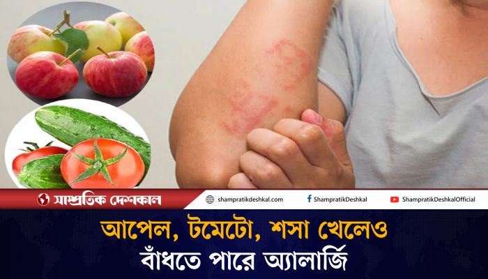 যে সব খাবারে অ্যালার্জি হতে পারে