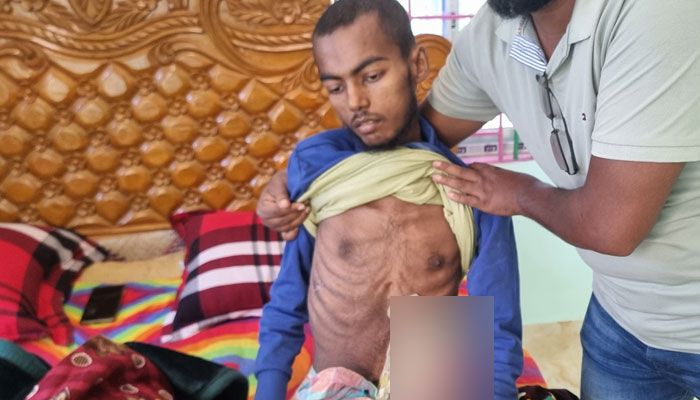 টাকার অভাবে ক্যান্সারের চিকিৎসা করাতে পারছেন না প্রবাসী নুরুল হুদা  