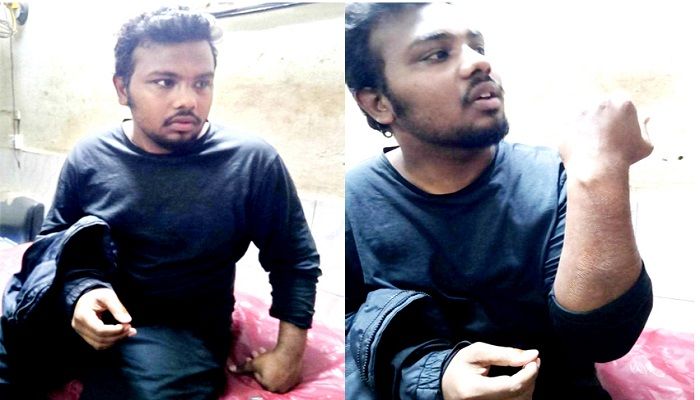 হাসপাতালে আহত সমন্বয়ক ইব্রাহিম হোসেন। ছবি: পাবনা প্রতিনিধি