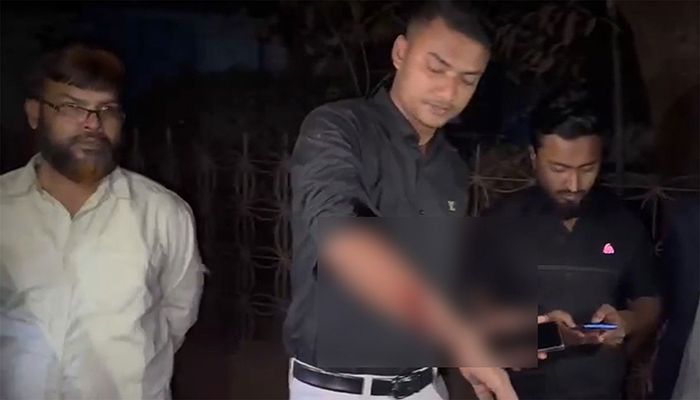 গুলিবিদ্ধ মোবাশ্বের হোসেন। ছবি: সংগৃহীত 