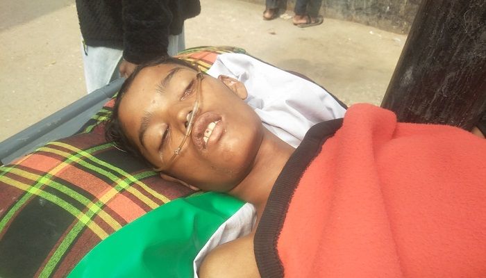 ১৭ দিনেও পরিচয় মেলেনি অচেতন সেই কিশোরের