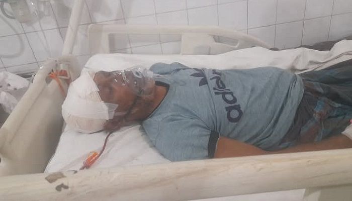 মিলনকে মাথায় অপারেশন করার পর তিনি এখনো চিকিৎসকদের নিবিড় পর্যবেক্ষণে রয়েছেন। ছবি: প্রতিনিধি