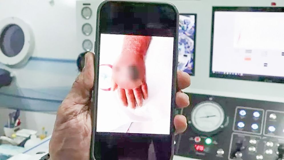 চোরের কামড়ে হাত হারাতে বসেছিলেন দোকানদার